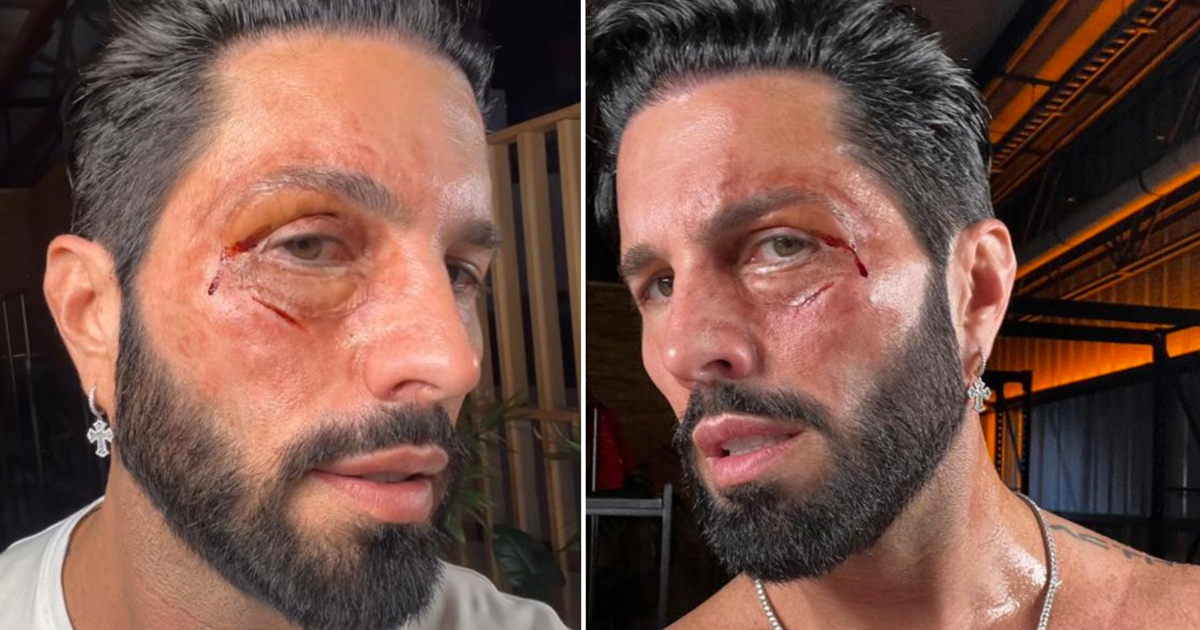 VIDEO: ¿Qué sucedió con Poncho de Nigris que apareció golpeado en redes?  post thumbnail image