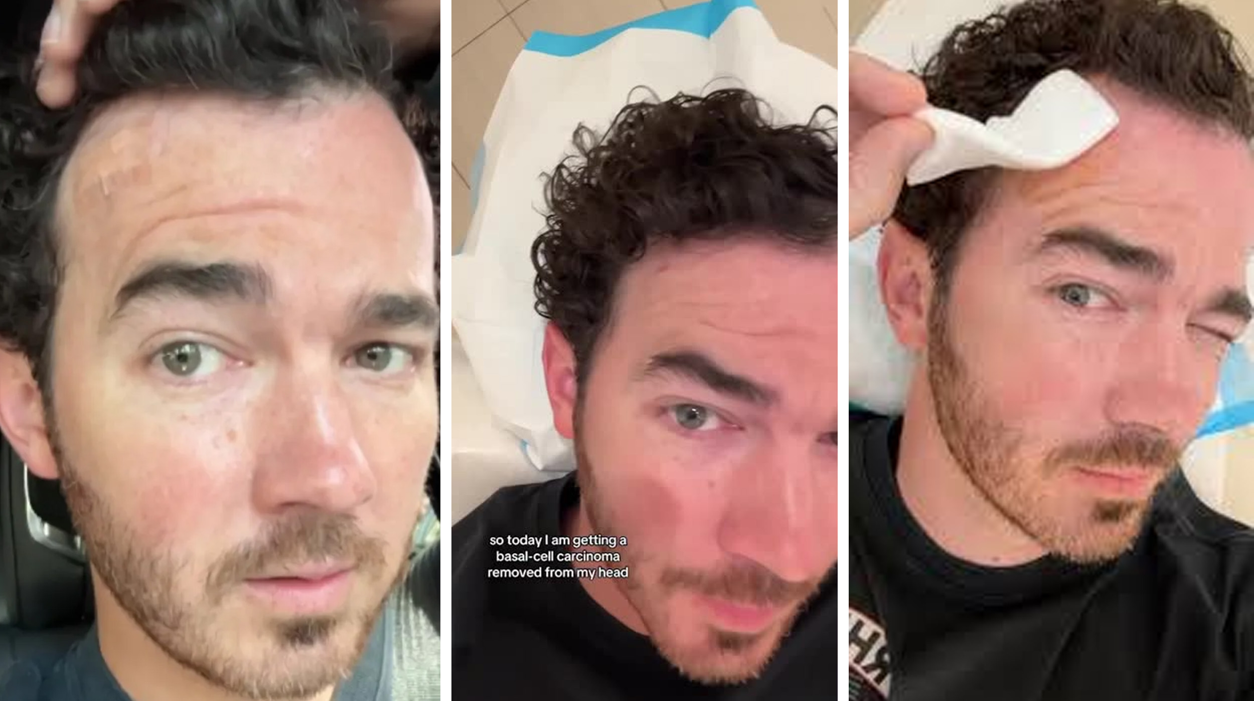 Pon atención a tus lunares: Kevin Jonas se sometió a cirugía para extirpar cáncer de piel post thumbnail image