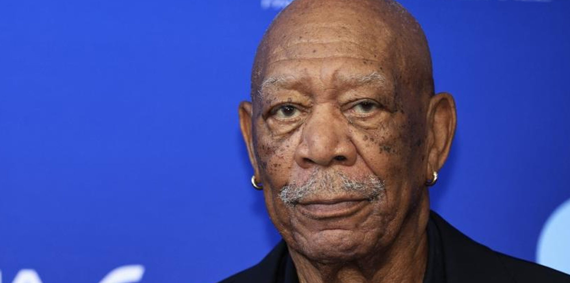 ¿Qué le pasó en la mano? Morgan Freeman desata preocupación a fans post thumbnail image